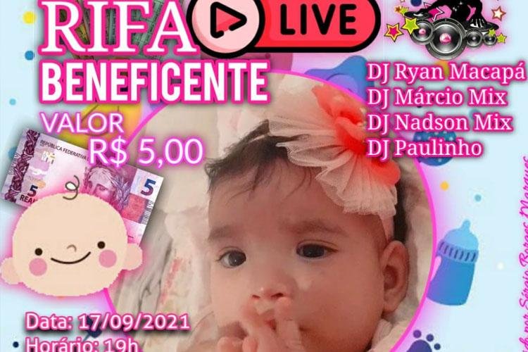 Rifa Live beneficente busca ajudar criança com Microcrania