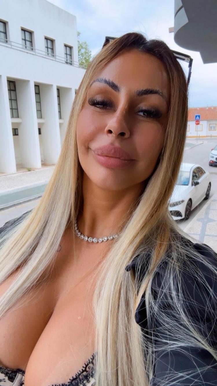 Influenciadora diz que precisou se afastar das redes por 10 dias após diagnóstico ligado ao uso de filtros