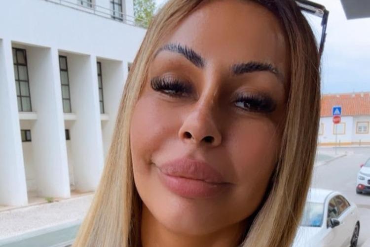 Influenciadora diz que precisou se afastar das redes por 10 dias após diagnóstico ligado ao uso de filtros