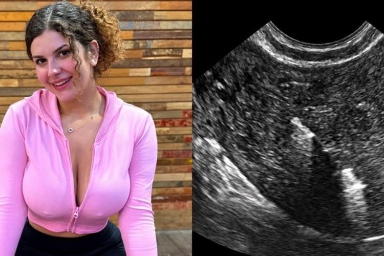 Influenciadora afirma ter perdido DIU após relação sexual
